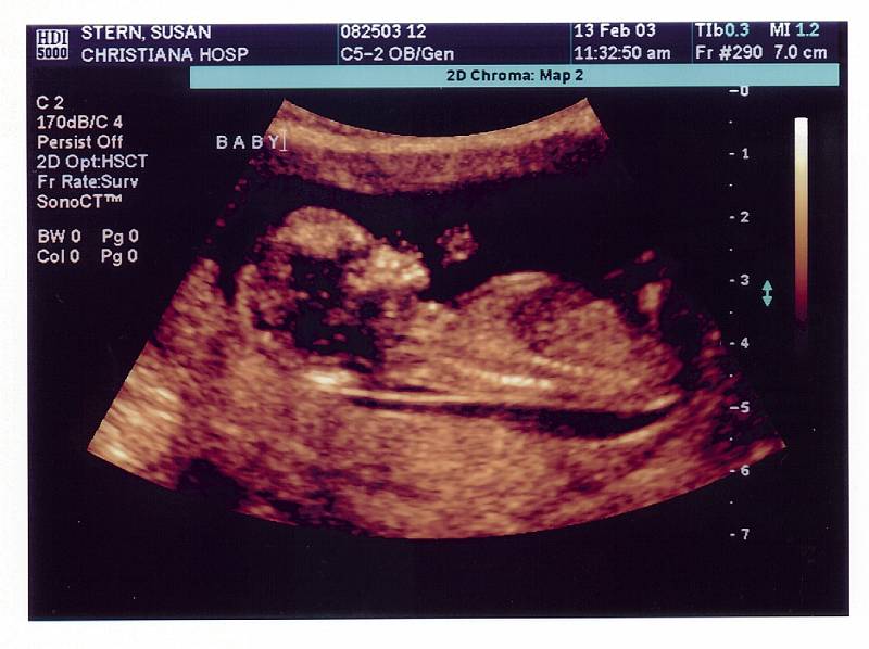 Peanut 03-02-13 13 Weeks