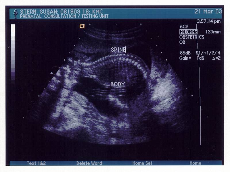 Peanut 03-03-21 18 Weeks (4)