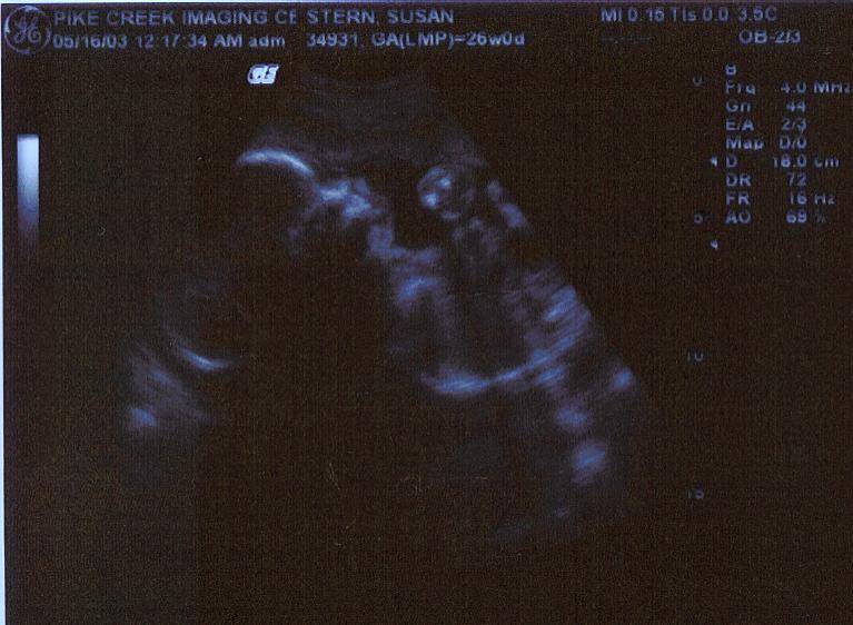 Peanut 03-05-16 26 Weeks (3)